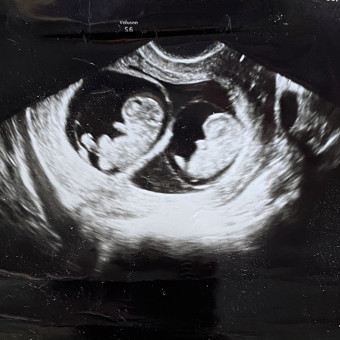 Babylist Registry Photo.