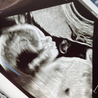Babylist Registry Photo.
