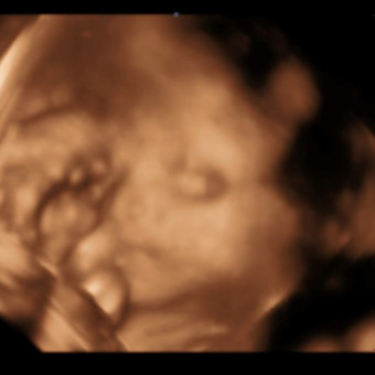 Babylist Registry Photo.