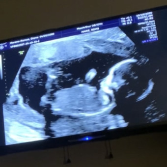 Babylist Registry Photo.