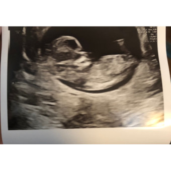 Babylist Registry Photo.
