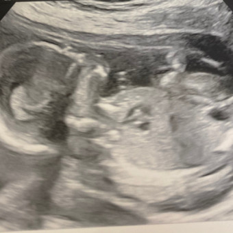 Babylist Registry Photo.