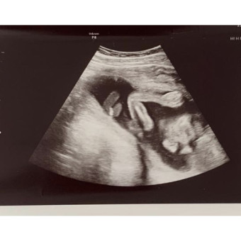 Babylist Registry Photo.