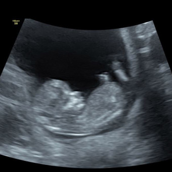 Babylist Registry Photo.