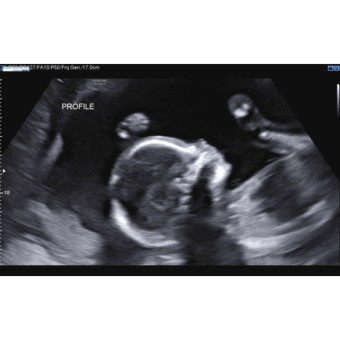 Babylist Registry Photo.