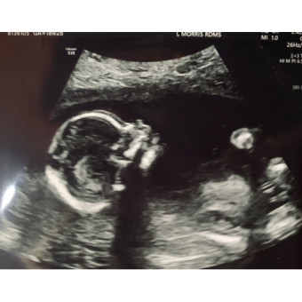 Babylist Registry Photo.