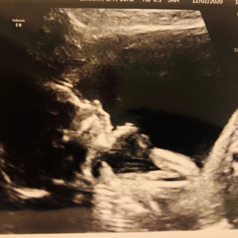 baby towels ackermans