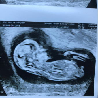 Babylist Registry Photo.