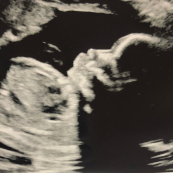 Babylist Registry Photo.