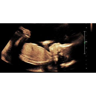 Babylist Registry Photo.