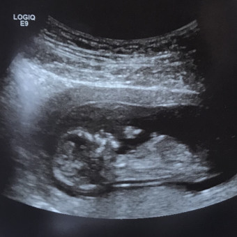 Babylist Registry Photo.