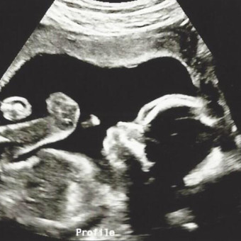 Babylist Registry Photo.