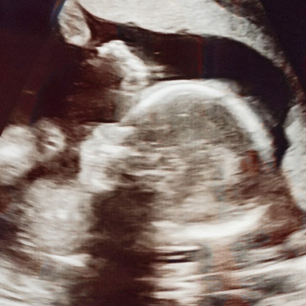 Babylist Registry Photo.