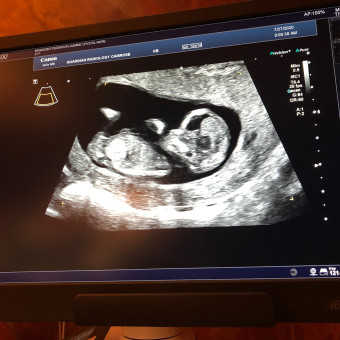 Babylist Registry Photo.