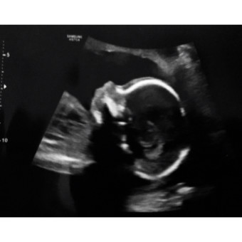 Babylist Registry Photo.