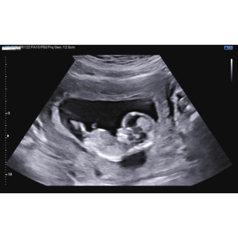 Babylist Registry Photo.