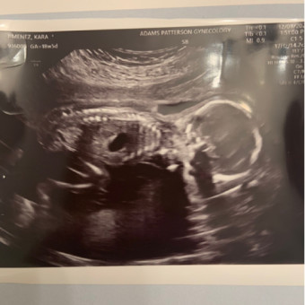 Babylist Registry Photo.