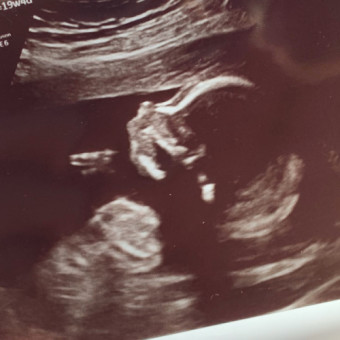 Babylist Registry Photo.