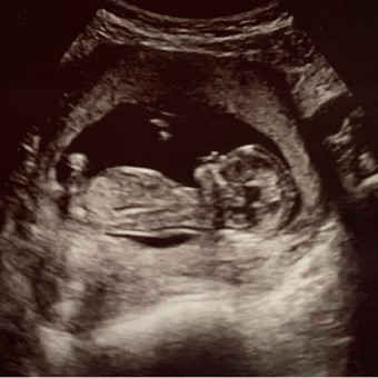 Babylist Registry Photo.