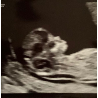 Babylist Registry Photo.