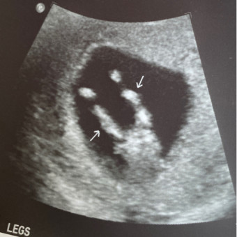 Babylist Registry Photo.