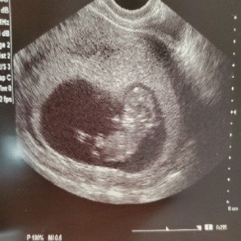 Babylist Registry Photo.