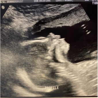 Babylist Registry Photo.
