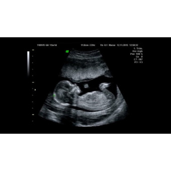 Babylist Registry Photo.