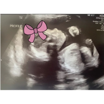 Babylist Registry Photo.