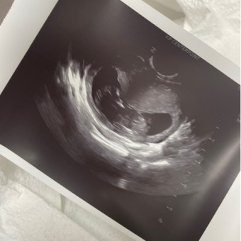 Babylist Registry Photo.