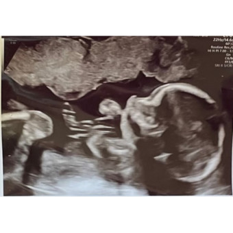 Babylist Registry Photo.