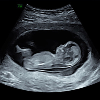 Babylist Registry Photo.