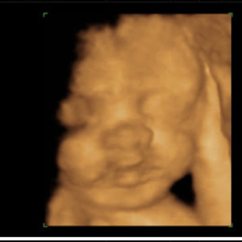 Babylist Registry Photo.