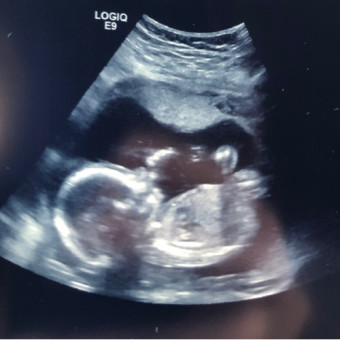 Babylist Registry Photo.