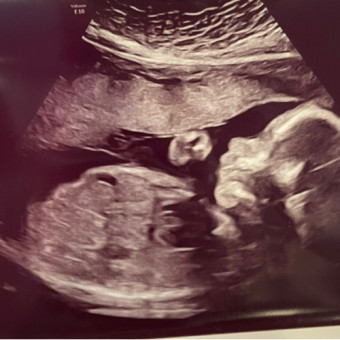 Babylist Registry Photo.