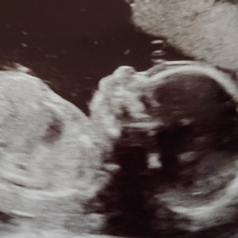 Babylist Registry Photo.