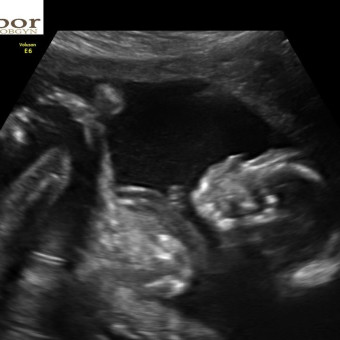 Babylist Registry Photo.