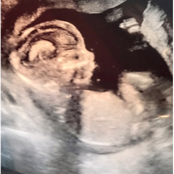 Babylist Registry Photo.