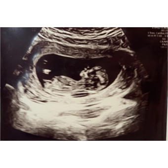 Babylist Registry Photo.