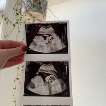 Babylist Registry Photo.