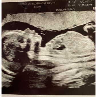 Babylist Registry Photo.