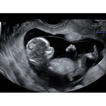 Babylist Registry Photo.