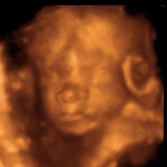 Babylist Registry Photo.