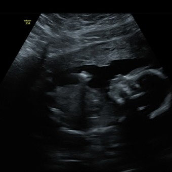Babylist Registry Photo.
