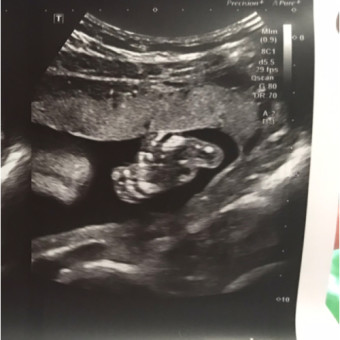 Babylist Registry Photo.