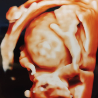 Babylist Registry Photo.