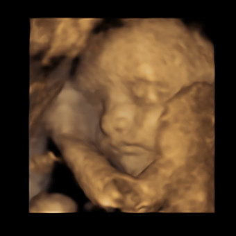 Babylist Registry Photo.