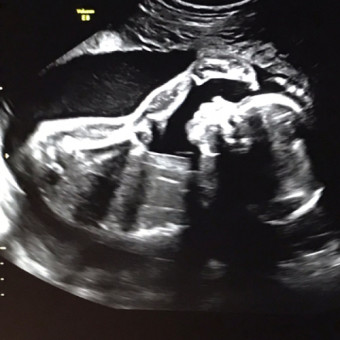 Babylist Registry Photo.