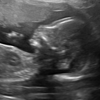 Babylist Registry Photo.