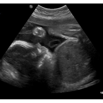 Babylist Registry Photo.